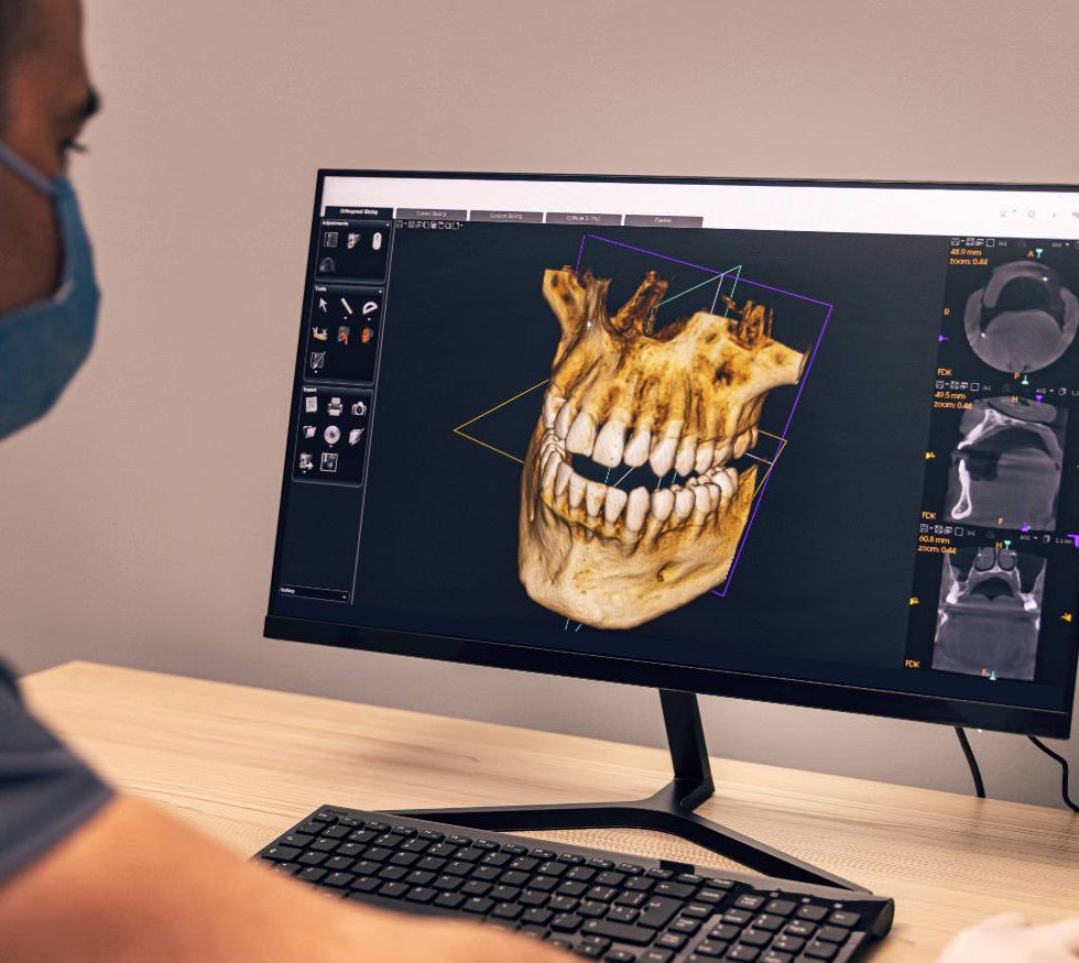 Urgencias Odontológicas:&nbsp;Restauración en resina, dientes fracturados o con caries