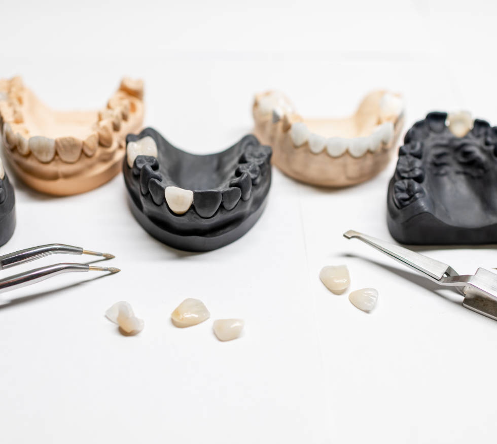 Prótesis dentales en Medellín: Recupera la función y estética de tu sonrisa