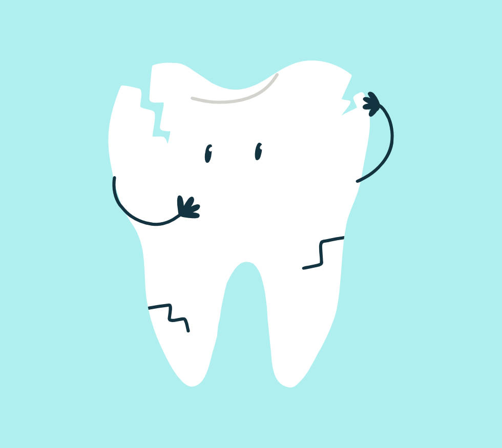 ¿Qué hacer si se fractura un diente? Pasos y tratamientos efectivos