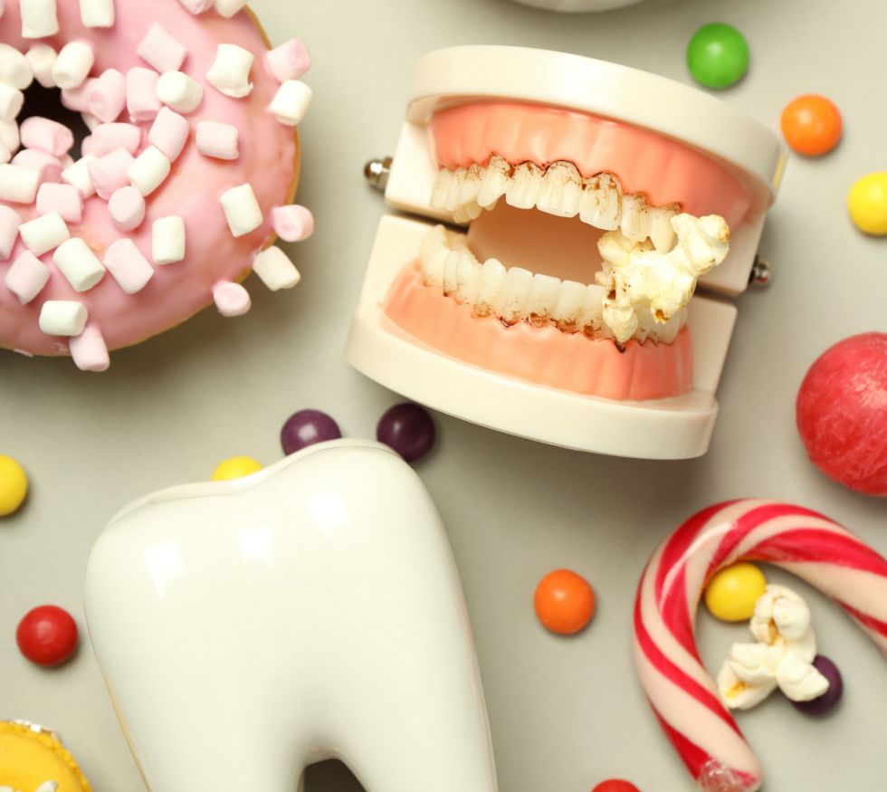 Caries en adultos: por qué están aumentando y cómo prevenirlas.