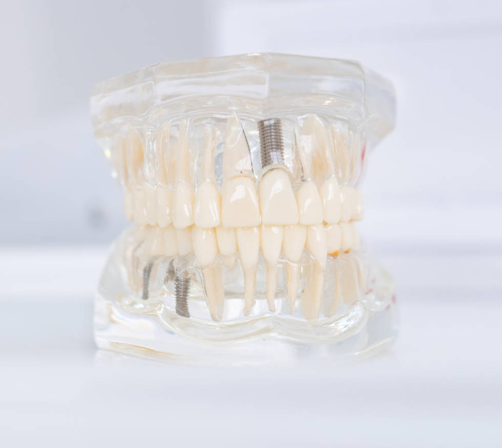 Especialistas en:&nbsp;Rehabilitación oral