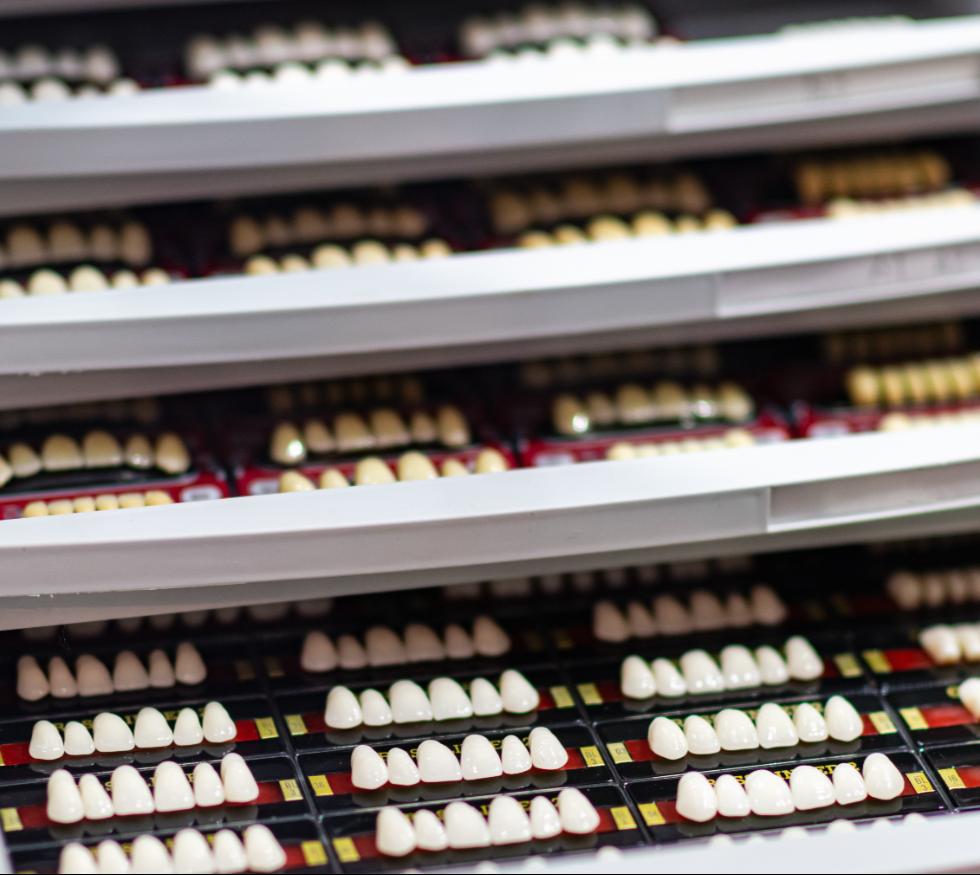 Carillas vs. resinas: ¿qué opción estética te conviene según tu caso?