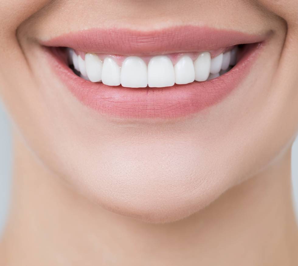 Diseño de sonrisa: qué es y cuándo es recomendable hacerlo