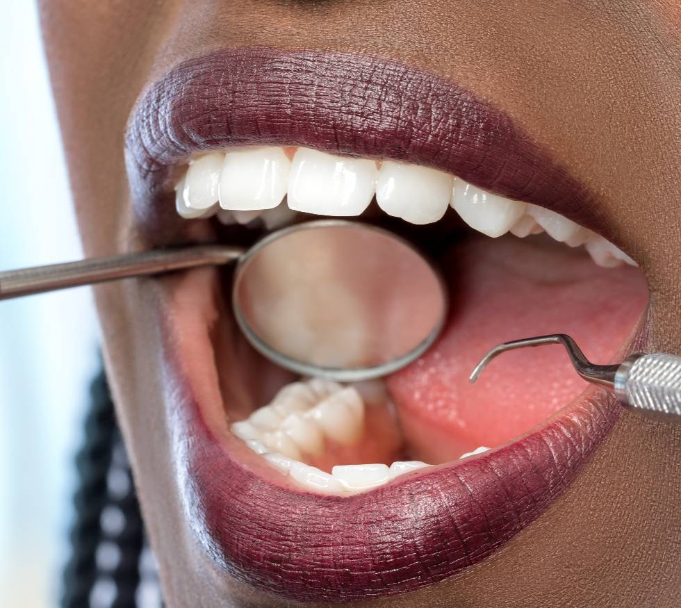 ¿Qué es la placa bacteriana y por qué es tan peligrosa?
